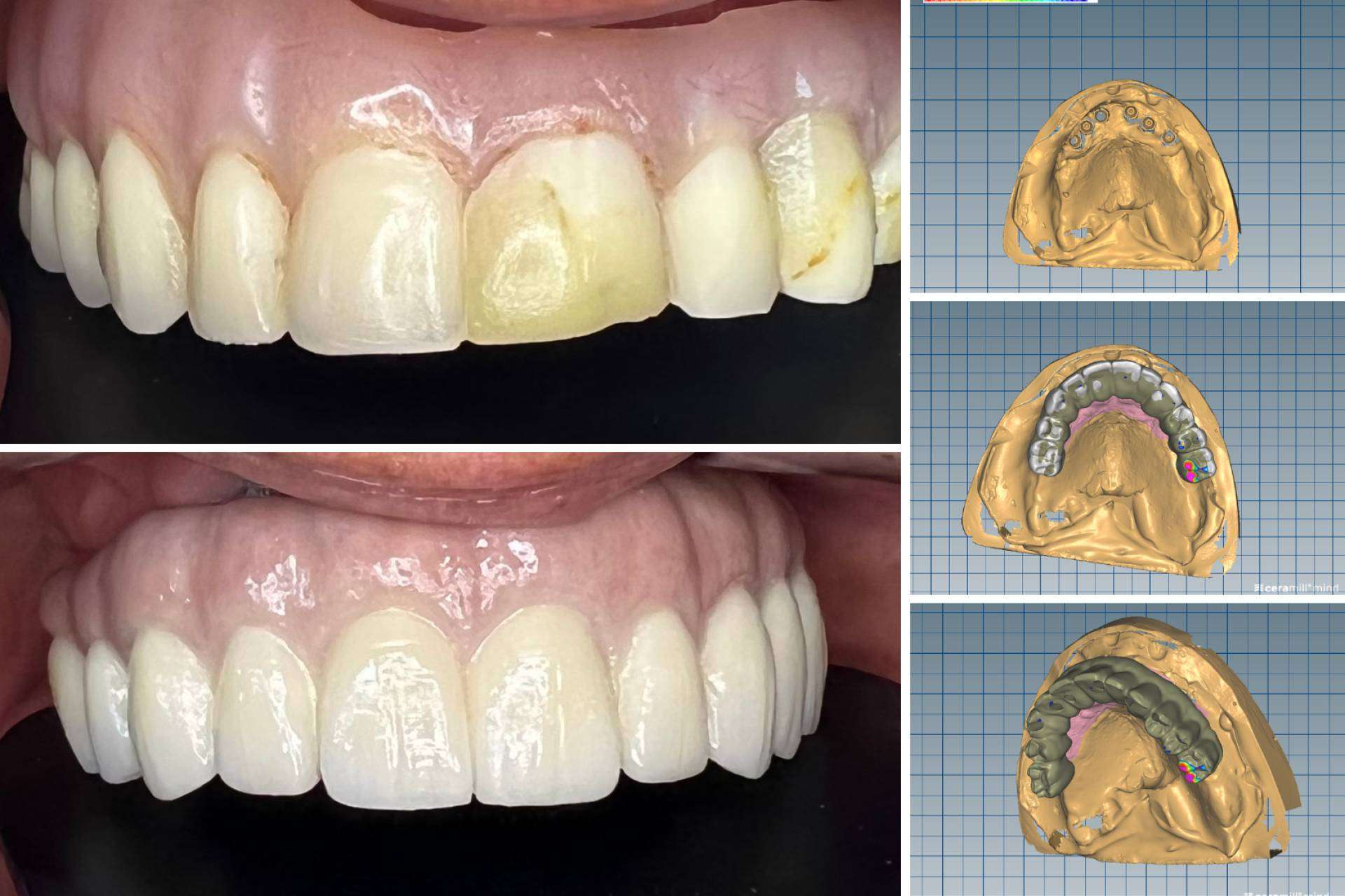 Clínica Dental Zavala, odontología avanzada en Lima